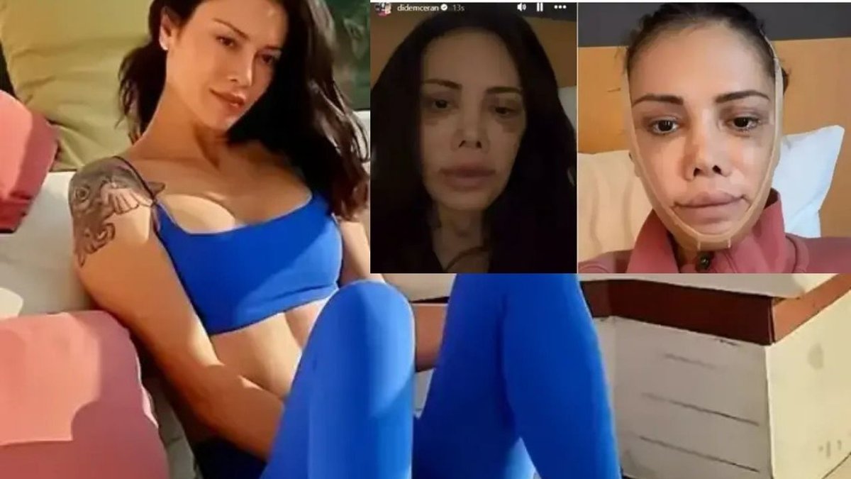 Didem Ceran’dan Dikkat Çeken İtiraf Ameliyat Sonrası Duygusal Mesaj
